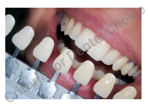 Criteria for Dental Choice