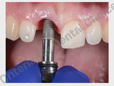 Criteria for Dental Choice: Comprehensive Guide 30