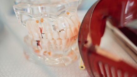 임플란트 치료 후 잇몸이 하얗게 변할 때 확인할 원인과 병원에 연락해야 하는 타이밍