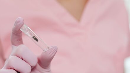 임플란트 치료 후 보철물에 이물감이 생길 때, 교합 조절 전 꼭 확인할 잇몸 적응·고정 상태 체크